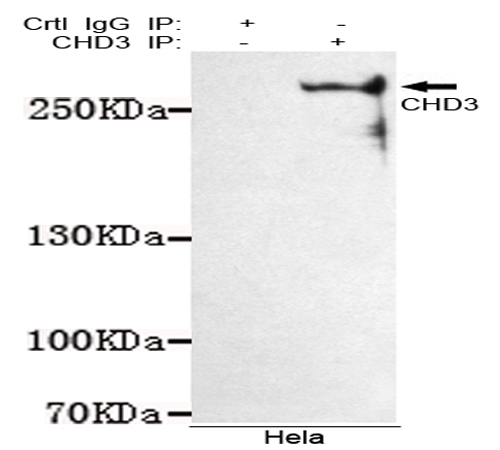 小鼠抗CHD3(C-term)单克隆抗体    