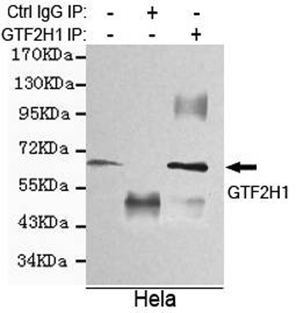 小鼠抗GTF2H1单克隆抗体 