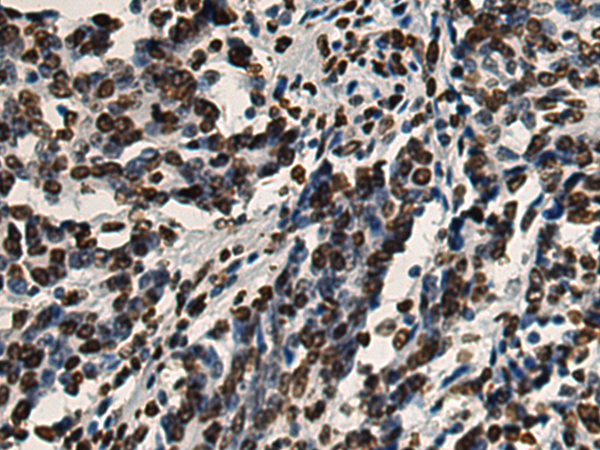 小鼠抗H3C1单克隆抗体   