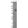 兔抗PAK56(Phospho-Ser602Ser560) 多克隆抗体