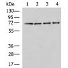 兔抗ZBTB16多克隆抗体  