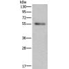  兔抗SLC38A1多克隆抗体
