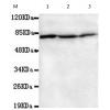 小鼠抗HSPA1A/HSPA1B(N-term)单克隆抗体