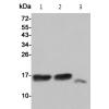 小鼠抗MAP1LC3A/MAP1LC3B单克隆抗体  