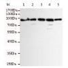 小鼠抗MSH2单克隆抗体  