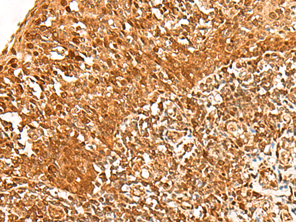 兔抗ADRM1多克隆抗体