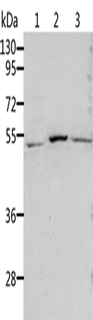 兔抗ALDH1B1多克隆抗体