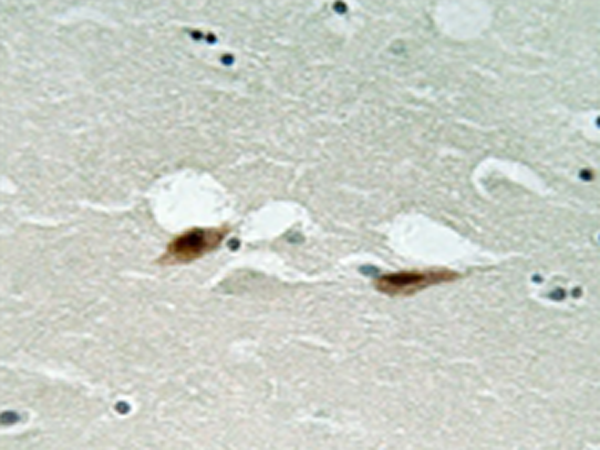 兔抗ATF2(Phospho-Ser472)多克隆抗体