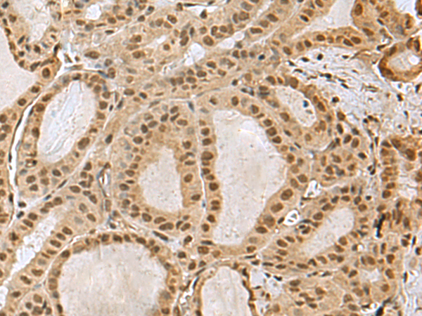 兔抗PRPF40A多克隆抗体