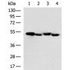 兔抗TP53多克隆抗体