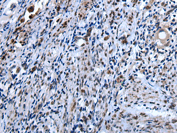兔抗ANP32A多克隆抗体