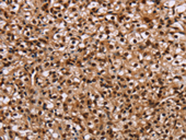 兔抗HMGN5多克隆抗体 