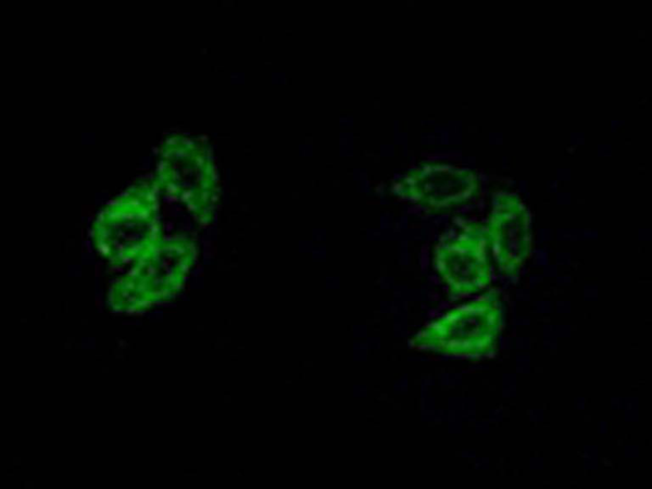 兔抗CSNK1A1/1L多克隆抗体
