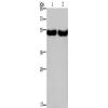 兔抗CXCR1多克隆抗体