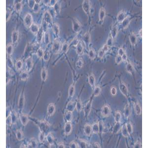MADB106大鼠乳腺癌细胞