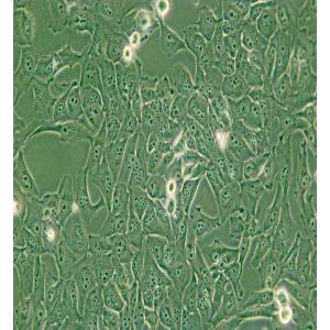 KMH-2人甲状腺癌细胞