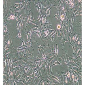 B16-F0小鼠黑色素瘤细胞