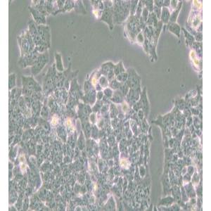 NCI-H520人肺鳞癌细胞
