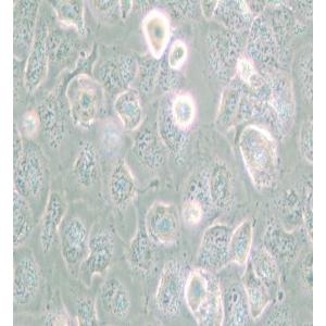 NCI-H661人大细胞肺癌细胞