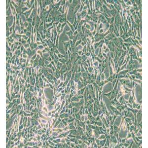 SUM159PT人乳腺癌细胞