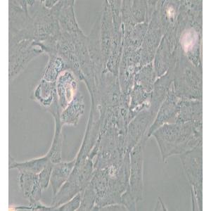 NCI-H196人小细胞肺癌细胞