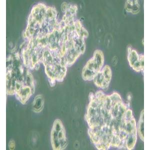 NCI-H209 [H209]人小细胞肺癌细胞