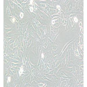 SW872人脂肪肉瘤细胞(L15) 