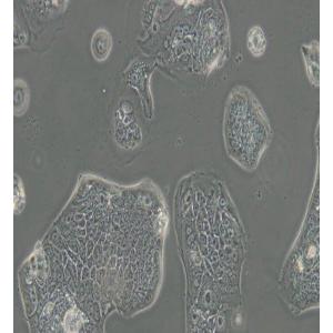 SW1116人结肠腺癌细胞(DMEM)