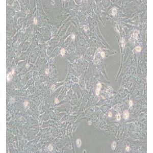 TTA1人甲状腺癌细胞