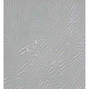 CCD-1095Sk人乳腺浸润性导管癌旁皮肤细胞