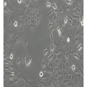 DU-145人前列腺癌细胞