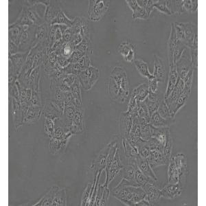 HT-1080[HT1080]人纤维肉瘤细胞