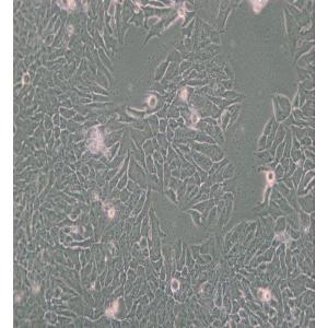 MDA-MB-361人乳腺癌细胞(L15) 