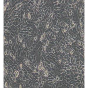 MDA-MB-435S人乳腺癌细胞/人黑素瘤细胞(M14污染细胞系)