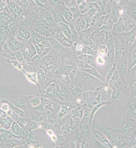 769-P人肾细胞腺癌细胞主图