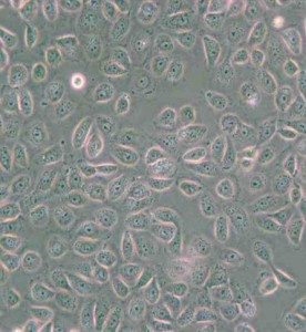 5637人膀胱癌细胞主图