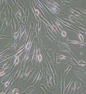 8305C人甲状腺癌细胞主图