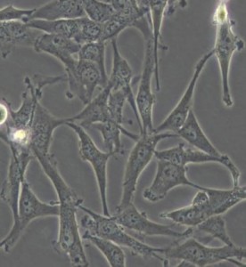 A172人胶质母细胞瘤细胞主图