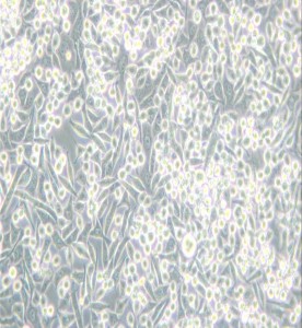 A-204 [A204]人横纹肌肉瘤细胞主图