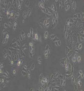 ACC-2人涎腺腺样囊性癌细胞主图