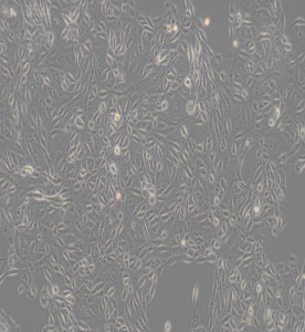 ACHN人肾细胞腺癌细胞主图