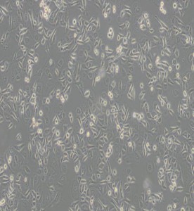 AGS人胃腺癌细胞主图