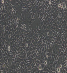 Bcap-37人乳腺癌细胞主图