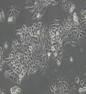 BEL-7402人肝癌细胞主图