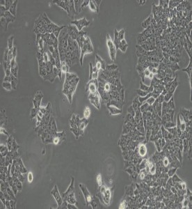 BIU-87人膀胱癌细胞主图