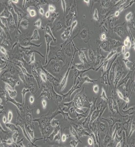 BT-549人乳腺管癌细胞主图