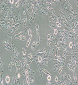 C643人甲状腺癌细胞主图