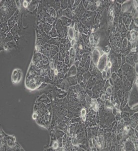 Caco-2人结直肠腺癌细胞主图