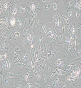 Caki-1人肾透明细胞癌皮肤转移细胞主图