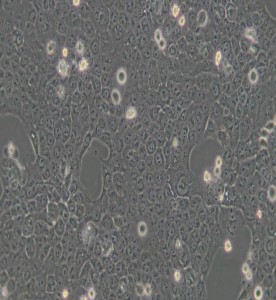 CAL-27人舌鳞癌细胞主图